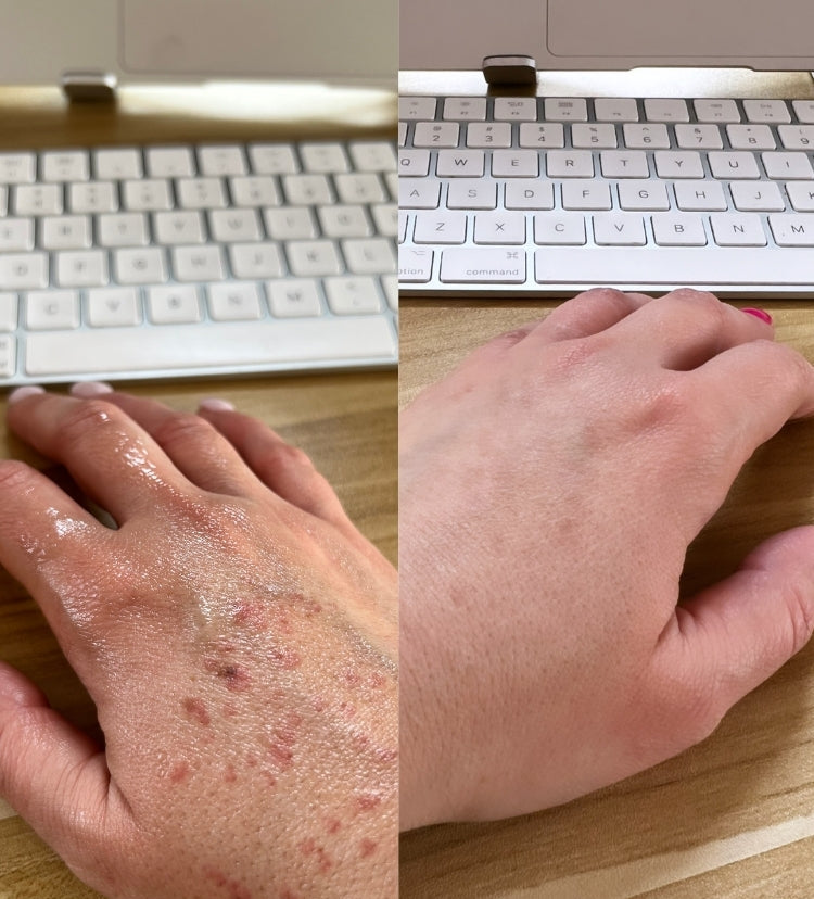 before and after in skin condition from Day 1 to Day 14, highlighting reduced redness, inflammation and dryness, showcasing the effectiveness of biobod&