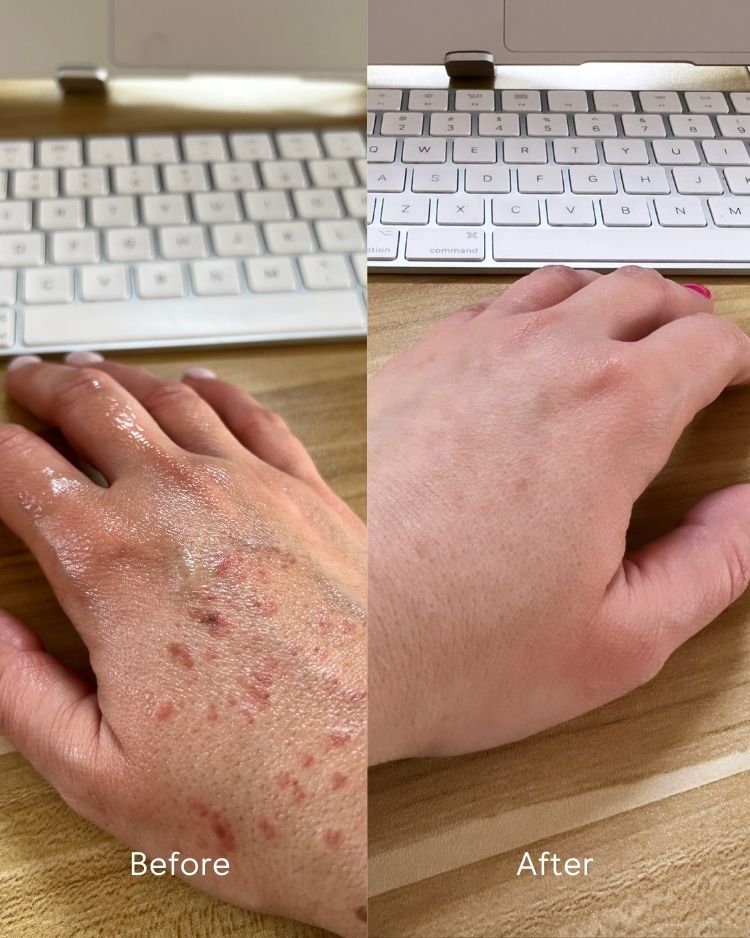 Before and after comparison of hands using a keyboard on a wooden desk.