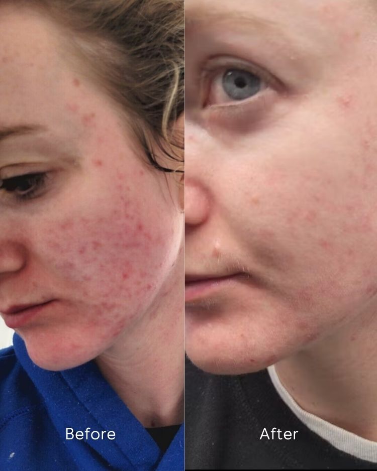 Before and after comparison of a person&