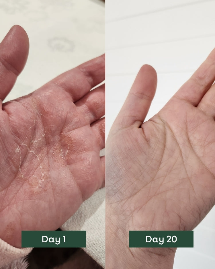 Intense Repair Duo: Nourish & Treat