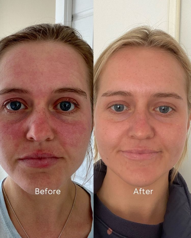 Before and after comparison of a person&