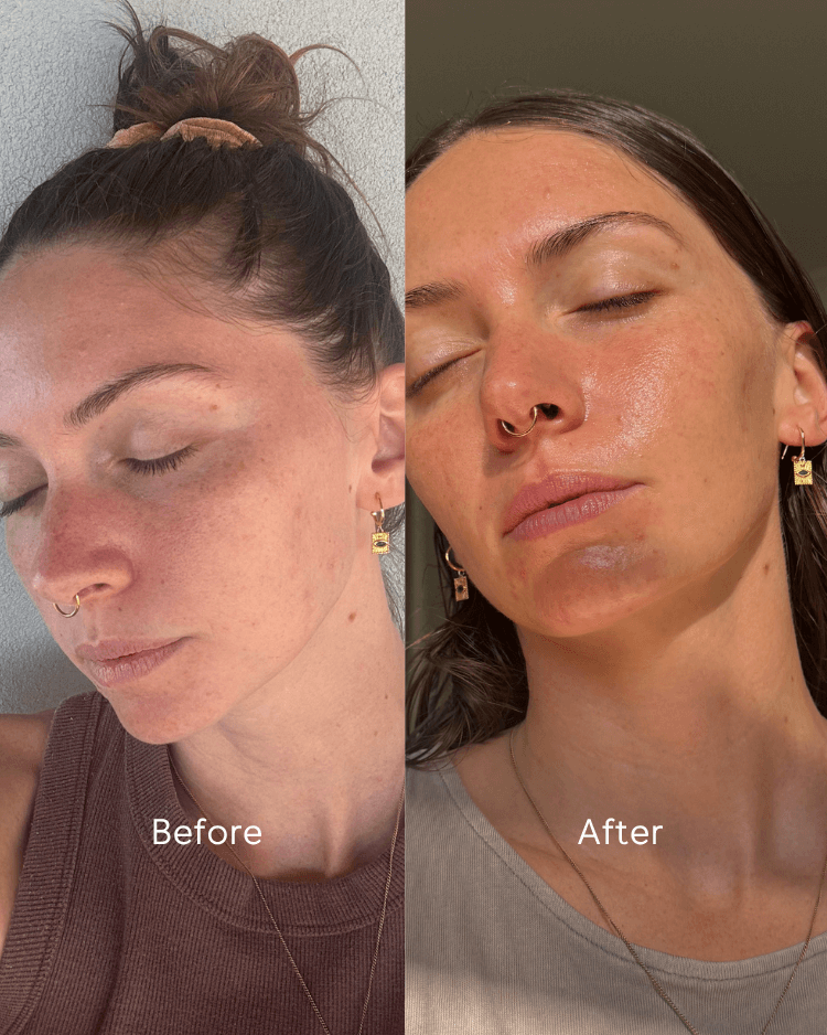 Before and after comparison of a woman&