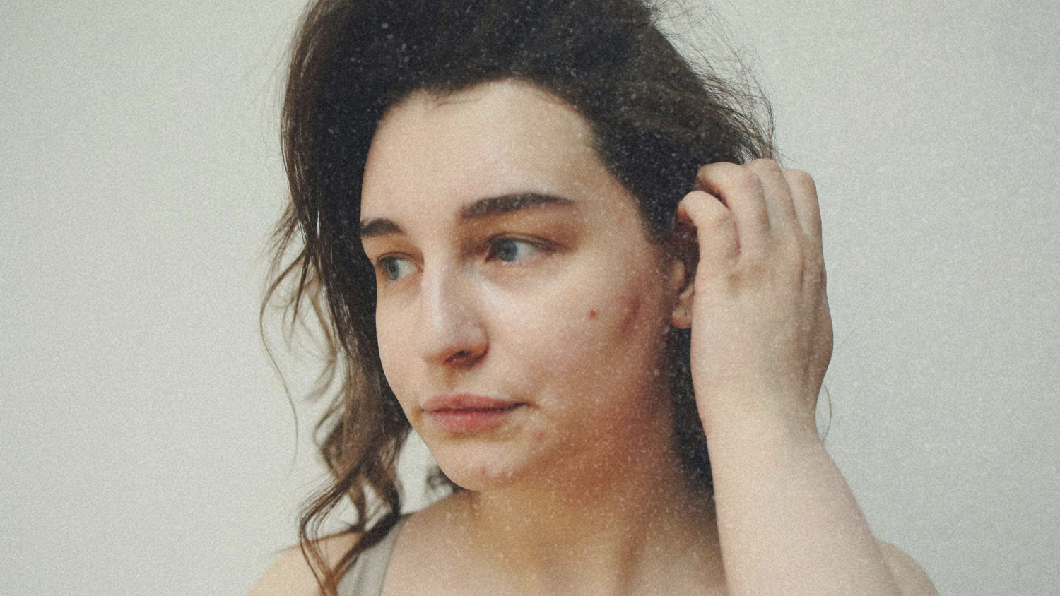 Can Damaged Skin Barrier Cause Acne? Young woman with acne and sensitive skin