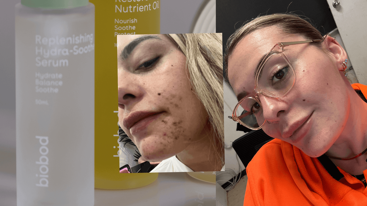 Can Skin Barrier Be Permanently Damaged