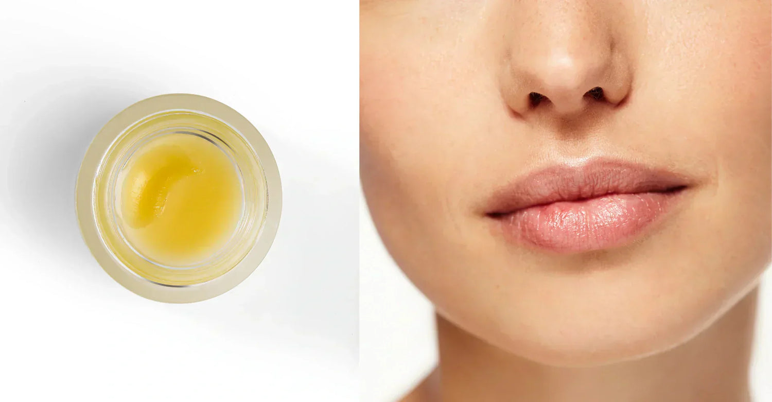 Cracked Lips Causes