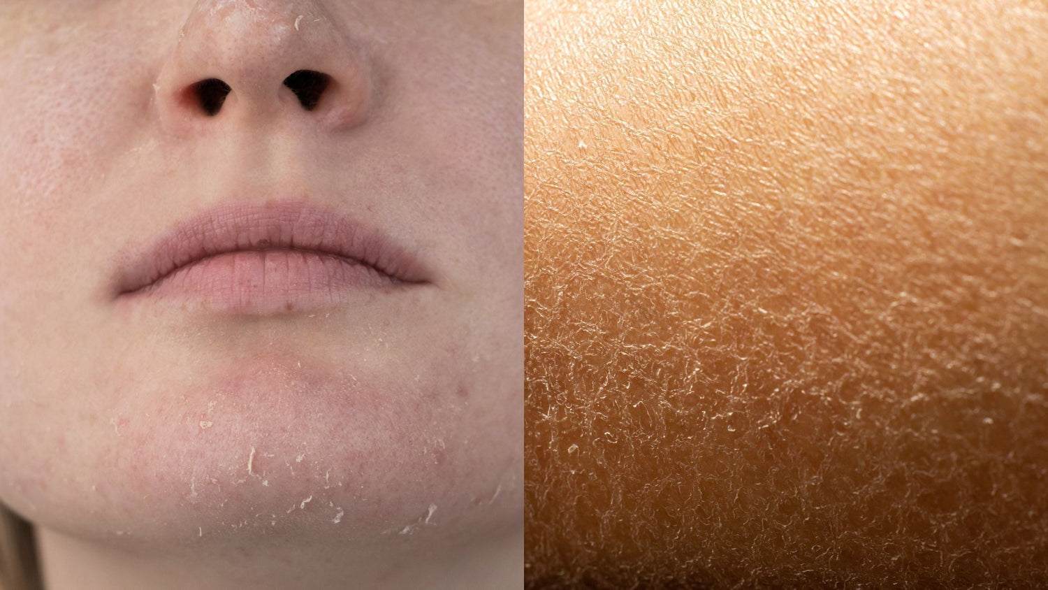 dry vs dehydrated skin, how to tell the difference