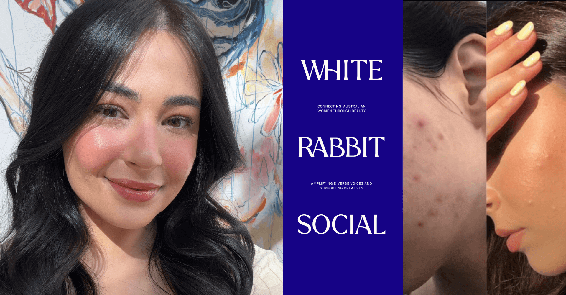 Minnie Isaac on Adult Acne, Building White Rabbit Social