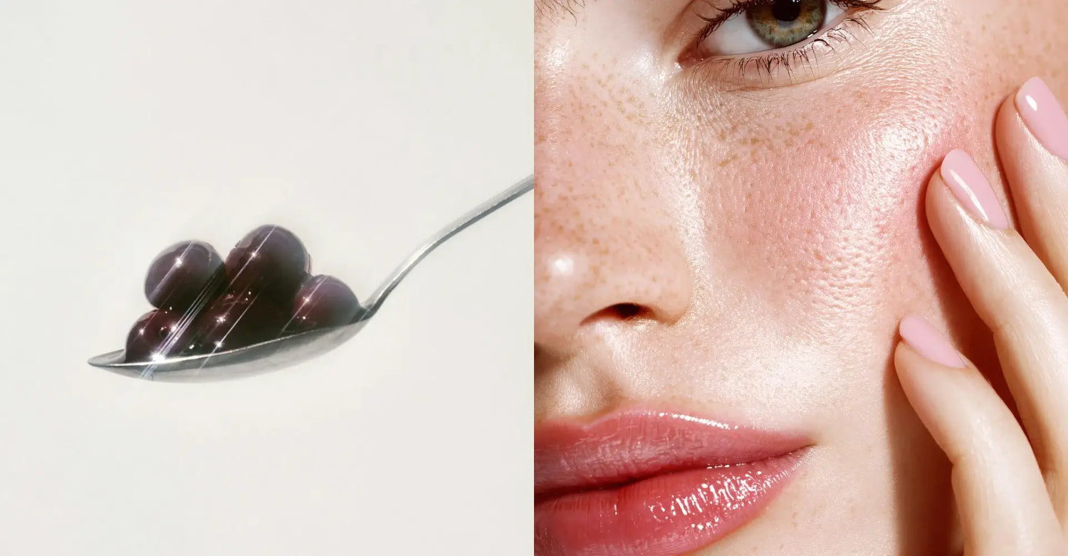 Natural probiotics for skin