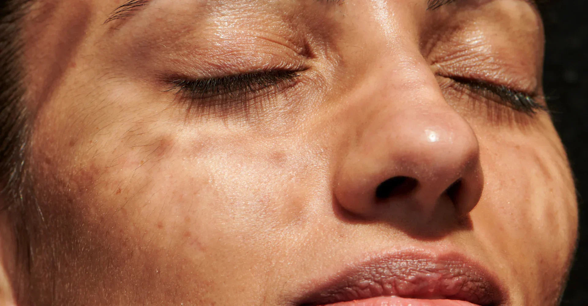 Restoring skin barrier health