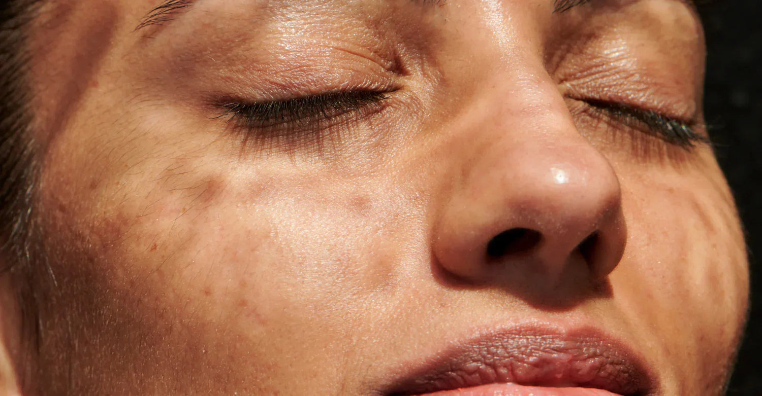Restoring skin barrier health