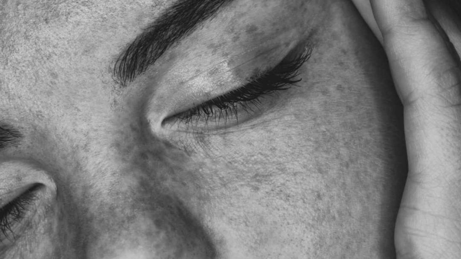 Sensitive Skin 101