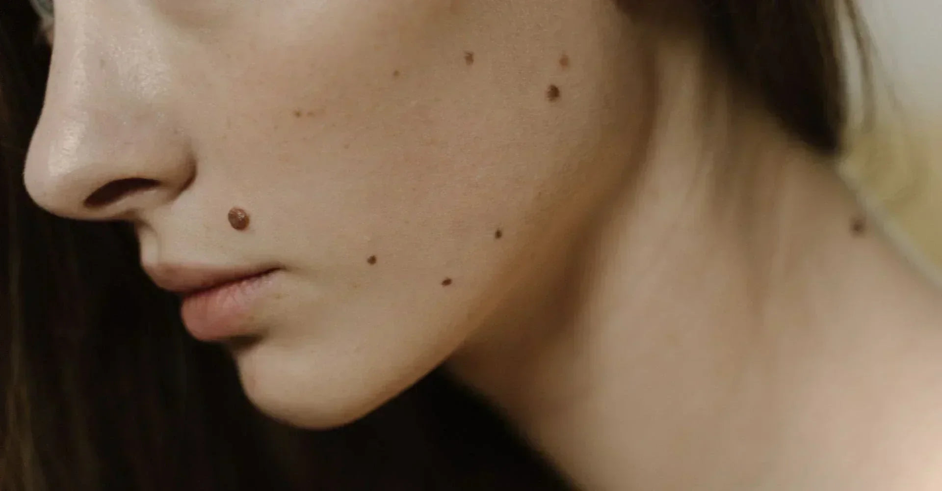 Sensitive skin symptoms