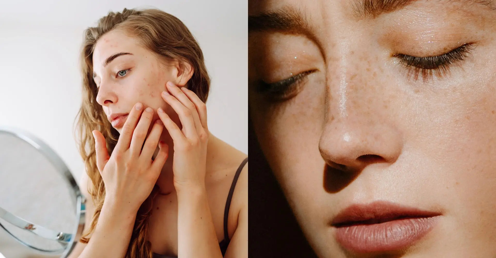 Sensitive Skin vs Sensitized Skin: How to Tell the Difference and Calm Your Skin Barrier