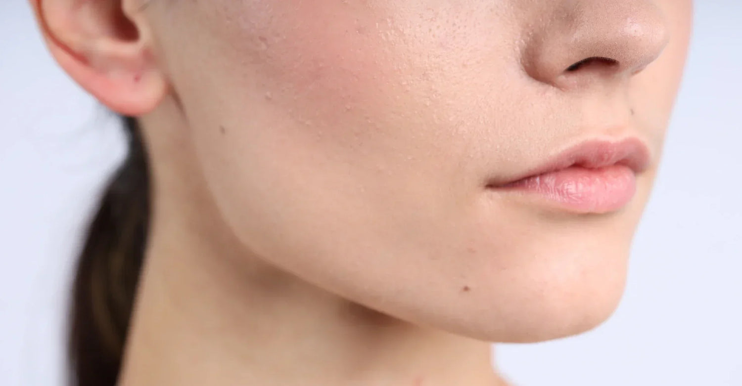 What Is Sebum in Skin? Understanding Sebum, Pores and Sebaceous Filaments
