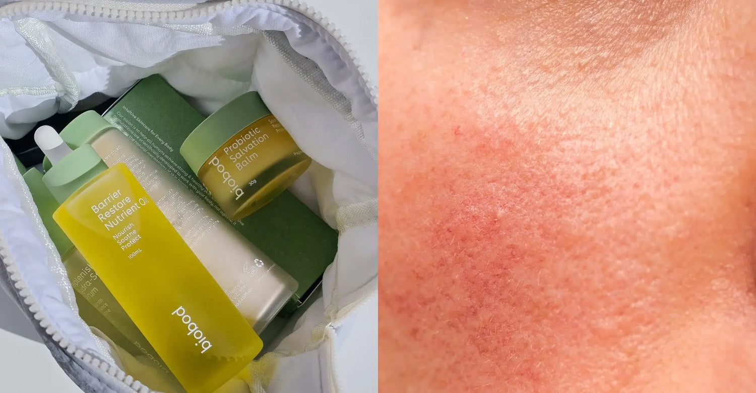 What skin care products are good for rosacea