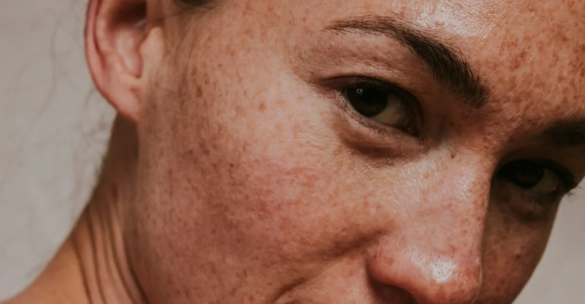 Healthy Skin vs Damaged Skin: How to Tell the Difference