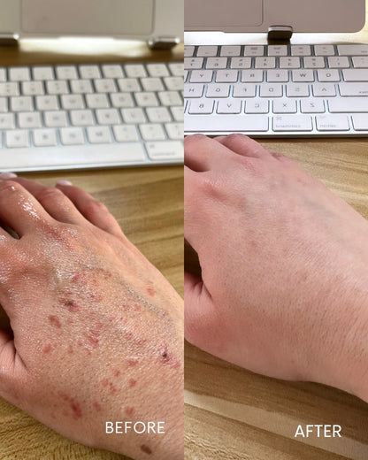 Before and after comparison of a hand with skin issues on a desk.