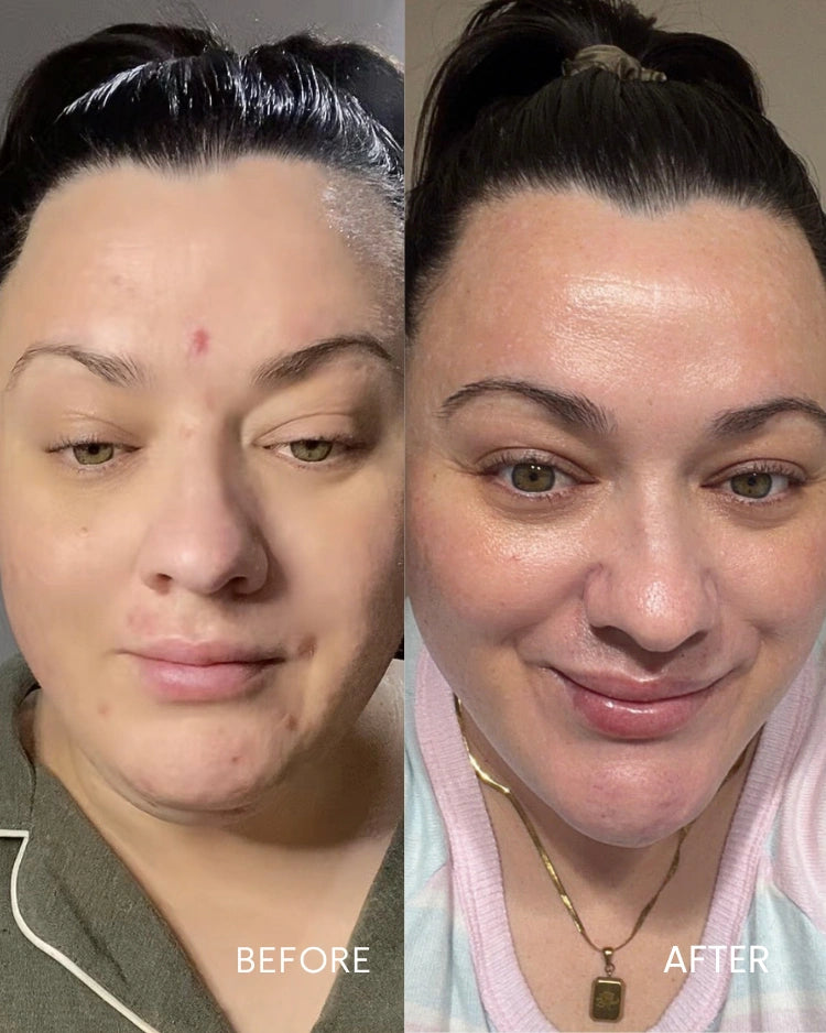 Skin Reset System: Brighten, Hydrate &amp; Nourish