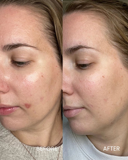 Skin Reset System: Brighten, Hydrate &amp; Nourish